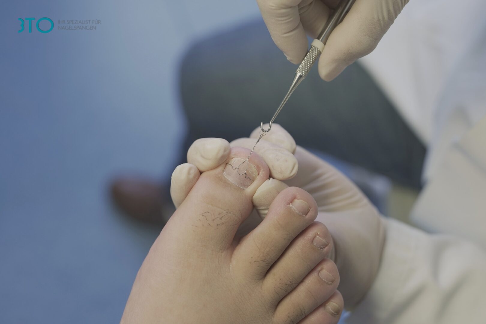 A person is getting their foot waxed