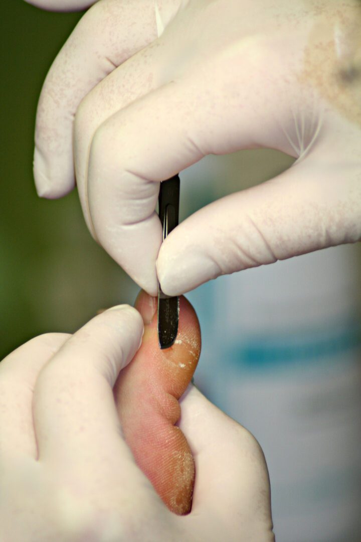 A person in white gloves is cutting something